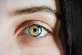Glaucoma eye disease causing optic nerve damage and vision loss